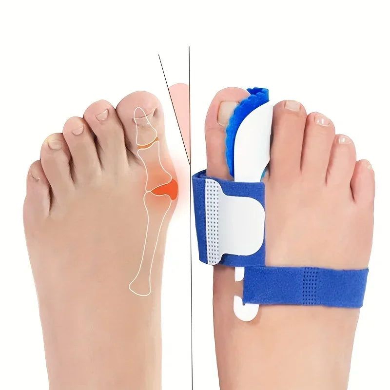 Corrector Foot Orthopedic Pro Tools Bunion Corrector Hallux Valgus Toe Separator Feet Care Thumb Belleza Y Salud