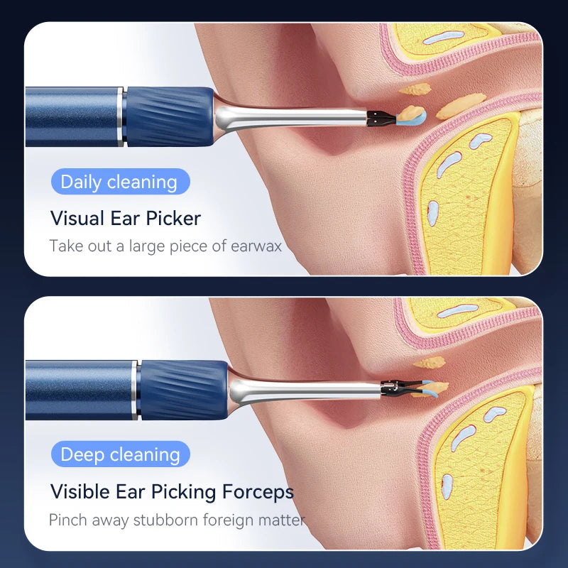 Ear Wax Removal Tool with 12MP Camera Ear Cleaner Omnidirectional Tweezers Wireless Earwax Remove Tool with 6 Ear Spoon Ear Care