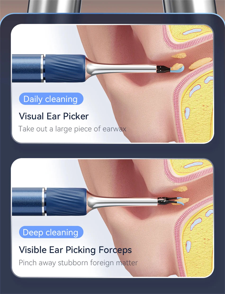 Ear Wax Removal Tool with 12MP Camera Ear Cleaner Omnidirectional Tweezers Wireless Earwax Remove Tool with 6 Ear Spoon Ear Care