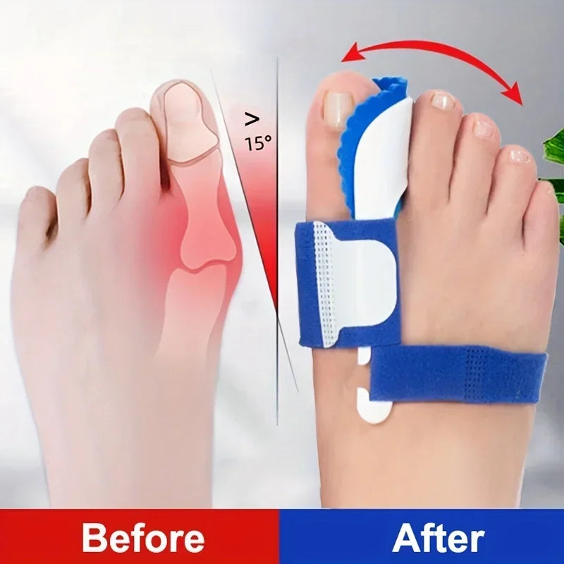 Corrector Foot Orthopedic Pro Tools Bunion Corrector Hallux Valgus Toe Separator Feet Care Thumb Belleza Y Salud