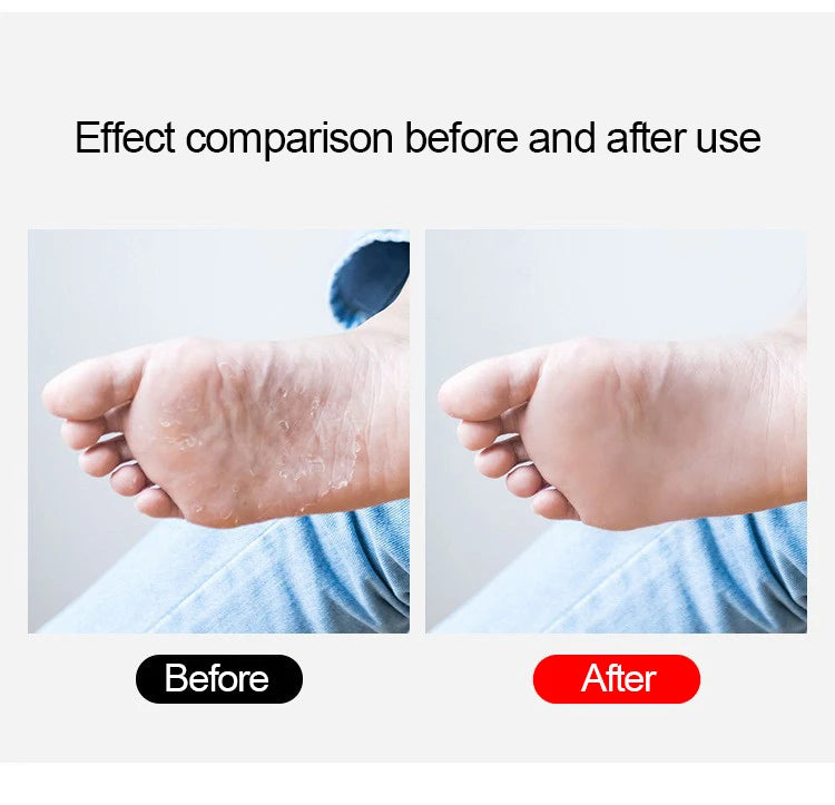 Heel Clean Pedicure Tools Callus Remover Foot Scrubber Foot File and Callus Remover Feet Massage Brush Manicure Foot Care Tools