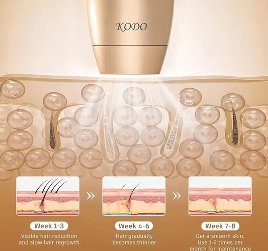 Ice laser hair removal device